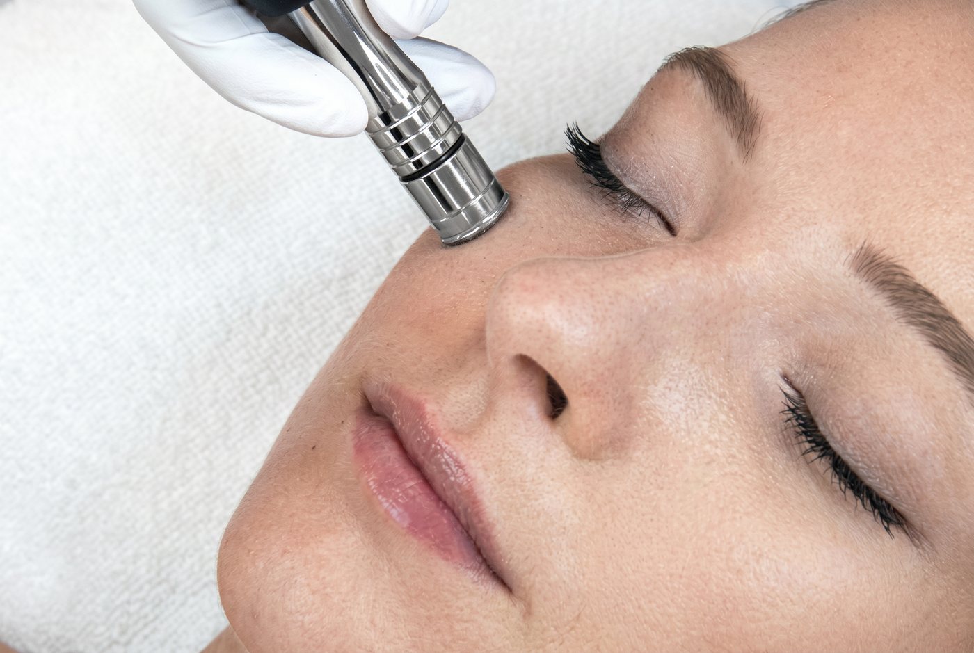 Diamant Microdermabrasion und Intensiv-Peeling bei Beauty Boulevard Frankenthal